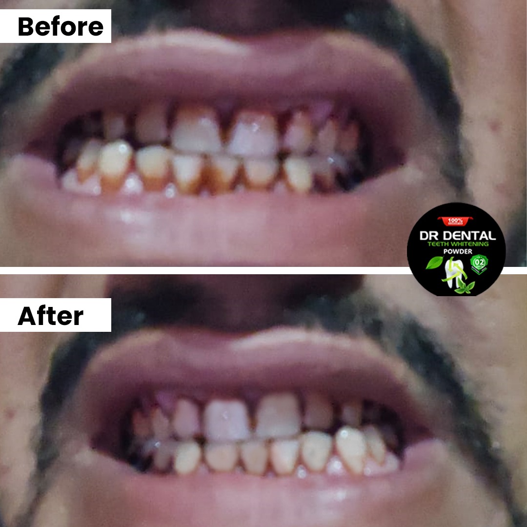 Dr Dental customer result — Kashif from Lahore