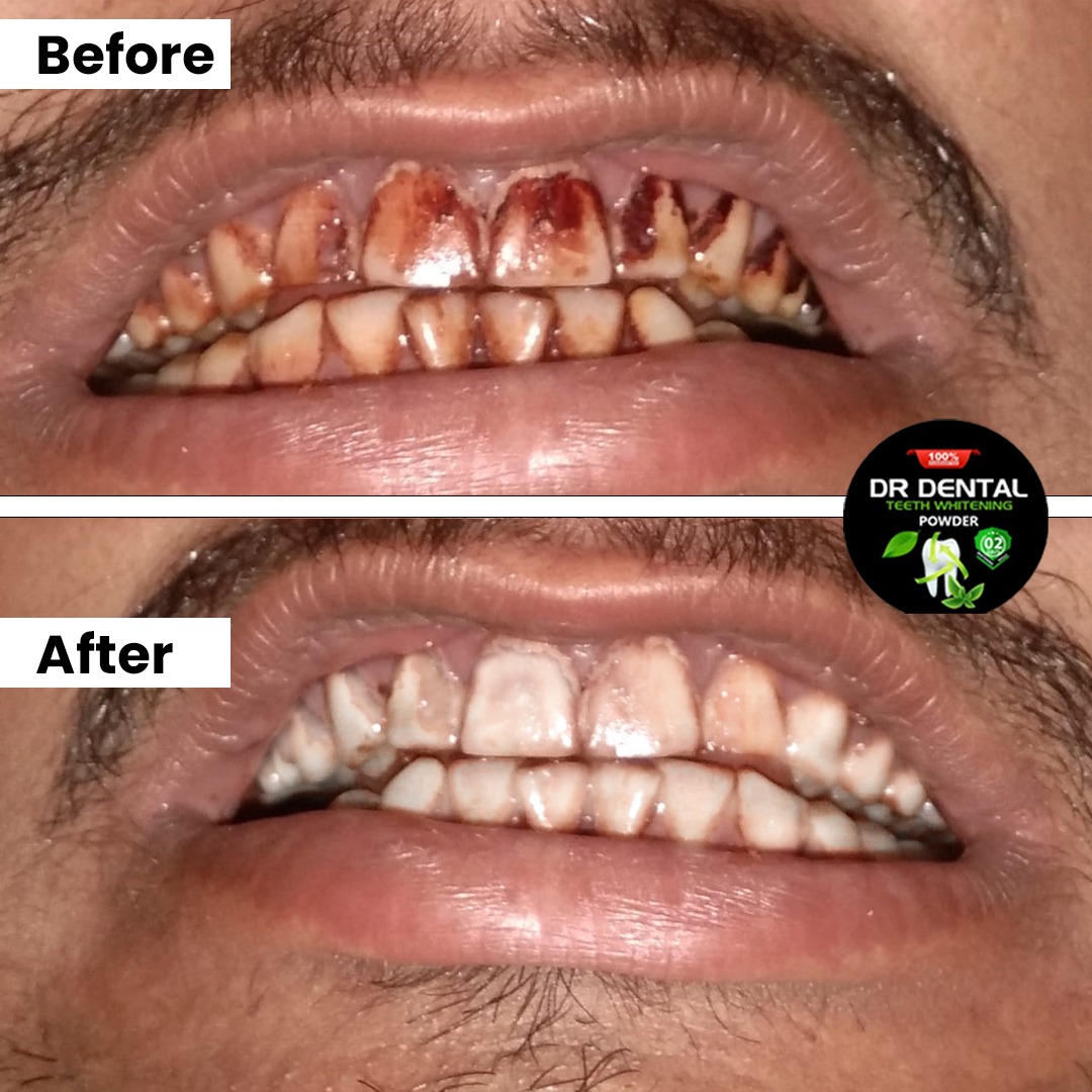Dr Dental customer result — Zubair's Live Result